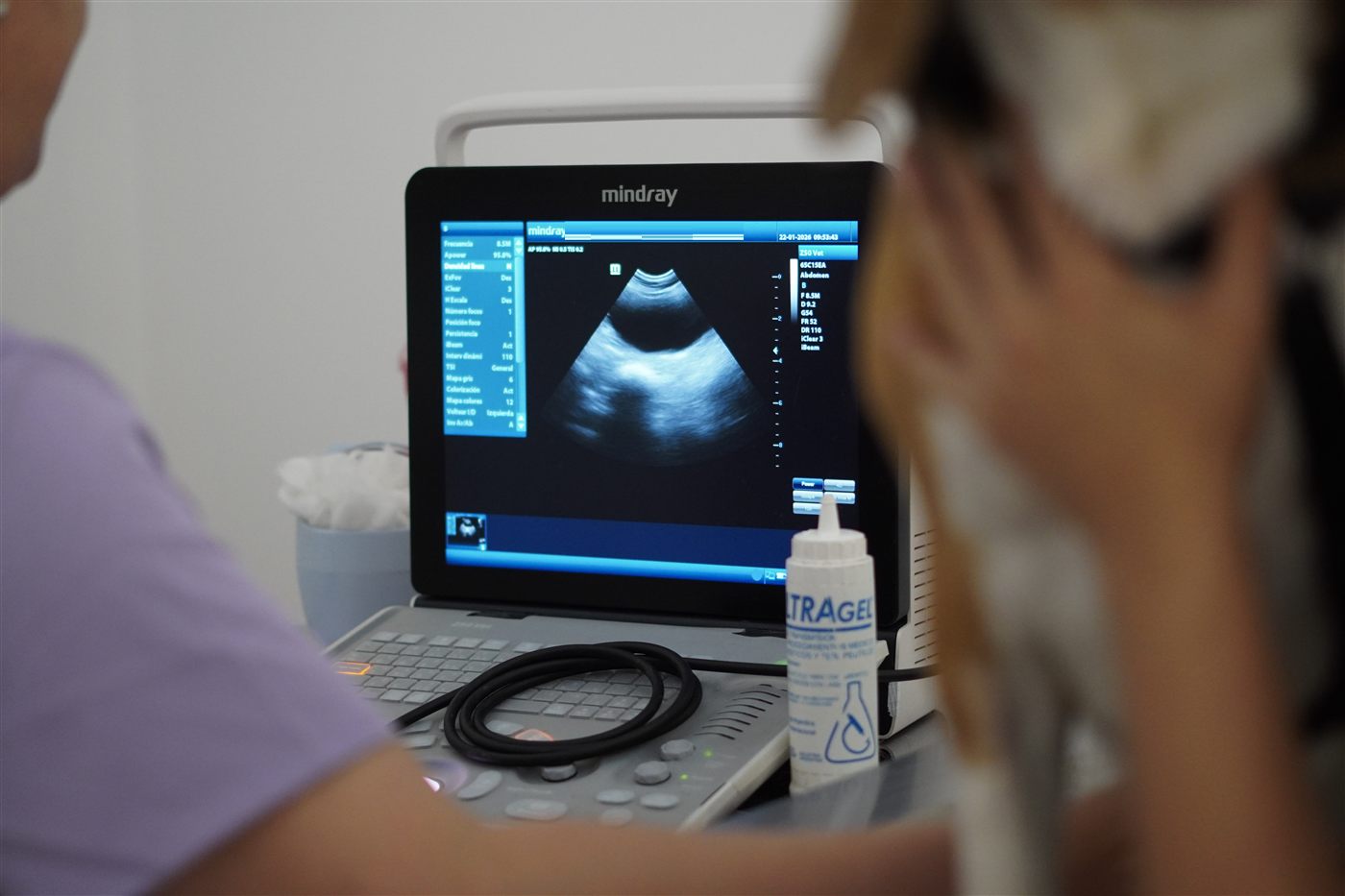Una profesional realiza una ecografía a un perro; en la pantalla del ecógrafo se ve la imagen del abdomen.